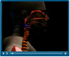 Voice disorder endoscopy video